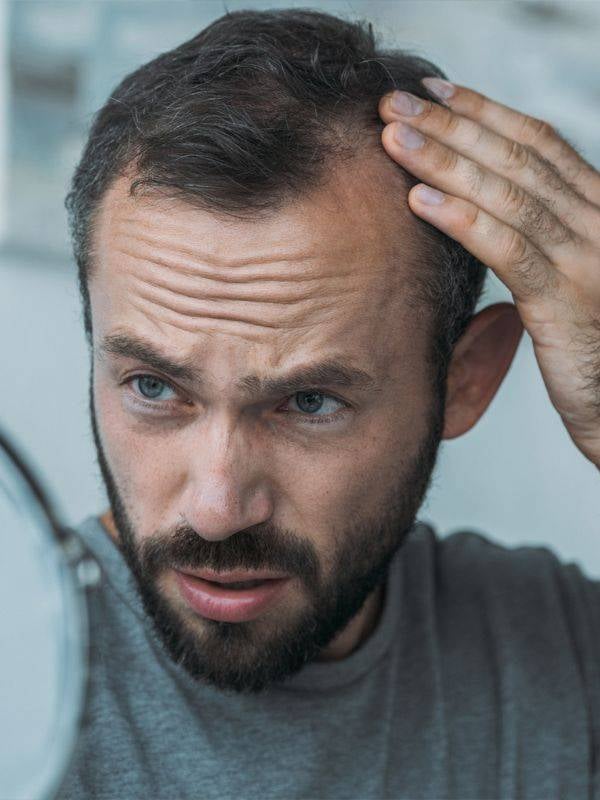 Wachstumsaktivierende Serum Elite Hair 100 ml – gegen Haarausfall, Phykosil & Sabal Serrulata, 98% natürliche Inhaltsstoffe