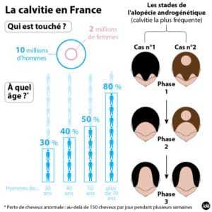 Schema der Kahlheit in Frankreich