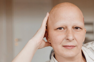 Was ist Alopezie?